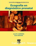 Ecografía en diagnóstico prenatal vignette