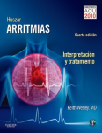 Huszar arritmias vignette