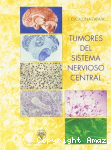 Tumores del sistema nervioso central vignette
