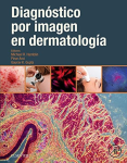 Diagnóstico por imagen en dermatología vignette