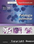 Patología pulmonar vignette