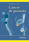 Cáncer de prostata vignette