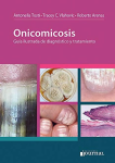 Onicomicosis vignette