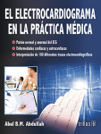 El electrocardiograma en la práctica médica vignette