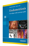Endometriosis vignette