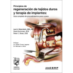 Principios de regeneración de tejidos duros y terapia de implantes vignette
