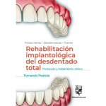 Rehabilitación implantológica del desdentado total vignette