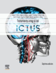 Tratamiento integral del ictus vignette