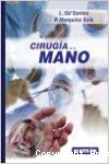 Cirugía de la mano vignette