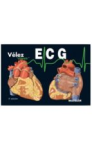 ECG. Electrocardiografía vignette
