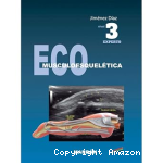 ECO Musculoesquelética vignette