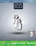 El libro del ECG vignette