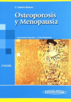 Osteoporosis y menopausia vignette