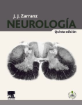 Neurología vignette