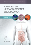 Avances en ultrasonografía endoscópica vignette