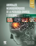Abordajes neuroquirúrgicos de la patología craneal y cerebral vignette