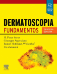Dermatoscopia vignette