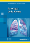 Patología de la pleura vignette