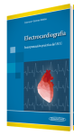 Electrocardiografía vignette