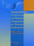 Restauraciones estéticas con resina compuesta en dientes posteriores vignette