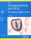 Interpretación del Ecg vignette