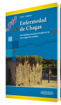Enfermedad de chagas vignette
