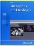 Imágenes en urología vignette